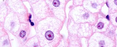 Microscopy image of hepatocytes stained in pink with purple nuclei.