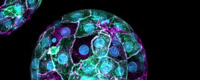 A developing embryo with DNA labeled blue, cell boundaries labeled pink, and certain cells fluorescing green.