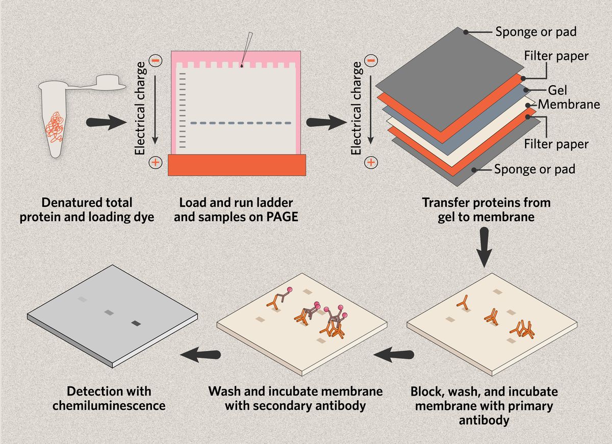 Steps in a typical western blot protocol: total protein is denatured and mixed with a loading dye; samples and molecular weight marker are loaded onto a polyacrylamide gel that separates the proteins using an electrical current and size-based matrix; proteins are transferred from gel to PVDF or nitrocellulose membrane by electrical charge; membranes are blocked, washed, and incubated with primary and secondary antibodies to detect specific target proteins; chemiluminescence or fluorescence detection allows protein visualization.