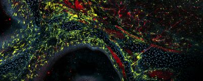 Fluorescence microscopy image of the brain and nasal cavity roof, with blood vessels, microglia, and nuclei labeled.