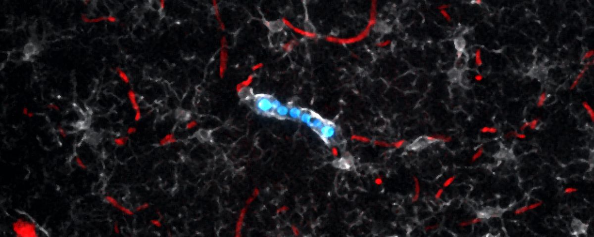 An image of fungi labeled blue inside of a white-labeled microglia, surrounded by red-labeled blood vessels.