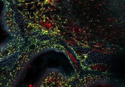 Fluorescence microscopy image of the brain and nasal cavity roof, with blood vessels, microglia, and nuclei labeled.