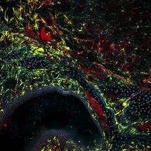 Fluorescence microscopy image of the brain and nasal cavity roof, with blood vessels, microglia, and nuclei labeled.