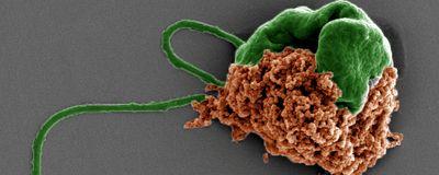 Pseudo-colored scanning electron microscope image of the algae microrobot with the algae in green and the drug-filled nanoparticles in orange.