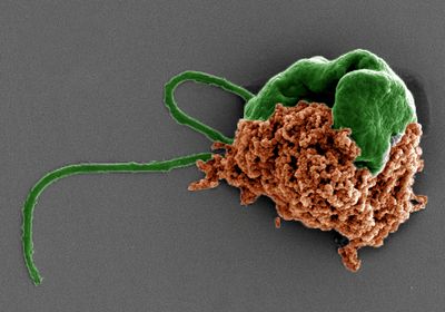 Pseudo-colored scanning electron microscope image of the algae microrobot with the algae in green and the drug-filled nanoparticles in orange.