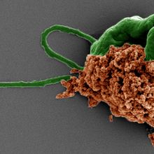 Pseudo-colored scanning electron microscope image of the algae microrobot with the algae in green and the drug-filled nanoparticles in orange.