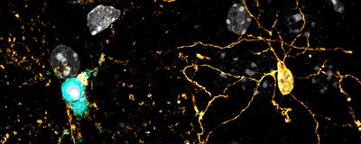 A small blue cell undergoing cell death next to a larger amber cell with extensive projections.