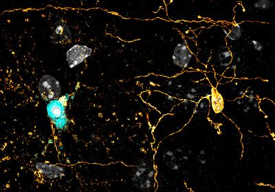 A small blue cell undergoing cell death next to a larger amber cell with extensive projections.