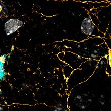 A small blue cell undergoing cell death next to a larger amber cell with extensive projections.