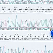 Chromatogram peaks of a DNA sequencing analysis.