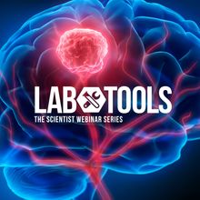 Viewing the Glioblastoma Tumor Microenvironment at Single Cell Resolution