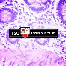 Technique Talk: Developing and Optimizing Immunohistochemistry Protocols