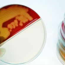 A researcher holds a Petri dish containing many bacterial colonies in red colored culture medium.