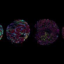 Four circular maps of color-coded immune cell types corresponding to the four tumor microenvironment archetypes.