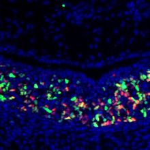 An image of cells on a black background, with some cells stained red and some others stained green.&nbsp;