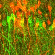 Cluster of red, green, and yellow neurons