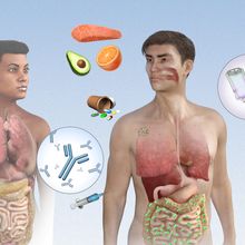 Illustration showing microbial signatures of cancer in the body