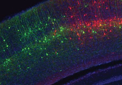 Microscopy image of green and red neurons in a blue section of cortex.