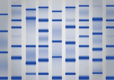 A gel with dye-labeled bands indicating proteins separated by electrophoresis.