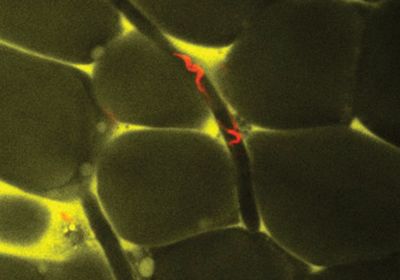 <em>T</em><em >rypanosoma brucei</em> parasites.