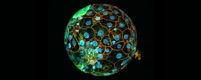 Confocal image of a developing embryo with blue-labeled nuclei and orange stained edges.