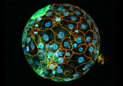 Confocal image of a developing embryo with blue-labeled nuclei and orange stained edges.