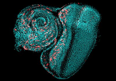 A fluorescent imaginal disc from <em >Drosophila&nbsp;</em>larvae on a black background.