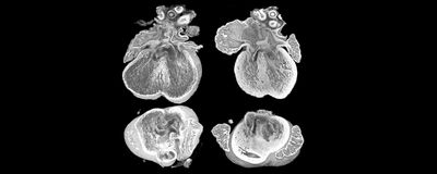 The heart sections on the left present defects while the hearts on the right do not show defects.