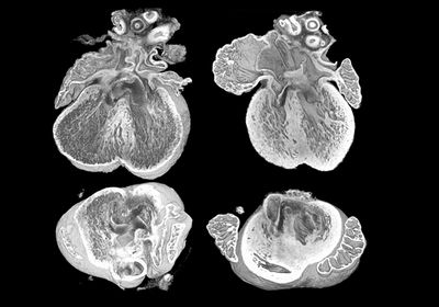 The heart sections on the left present defects while the hearts on the right do not show defects.&nbsp;