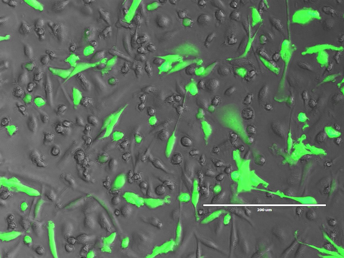 Photograph of green fluorescence, representing Marburg virus, in macrophages overlaid on a brightfield image of the cells in gray.