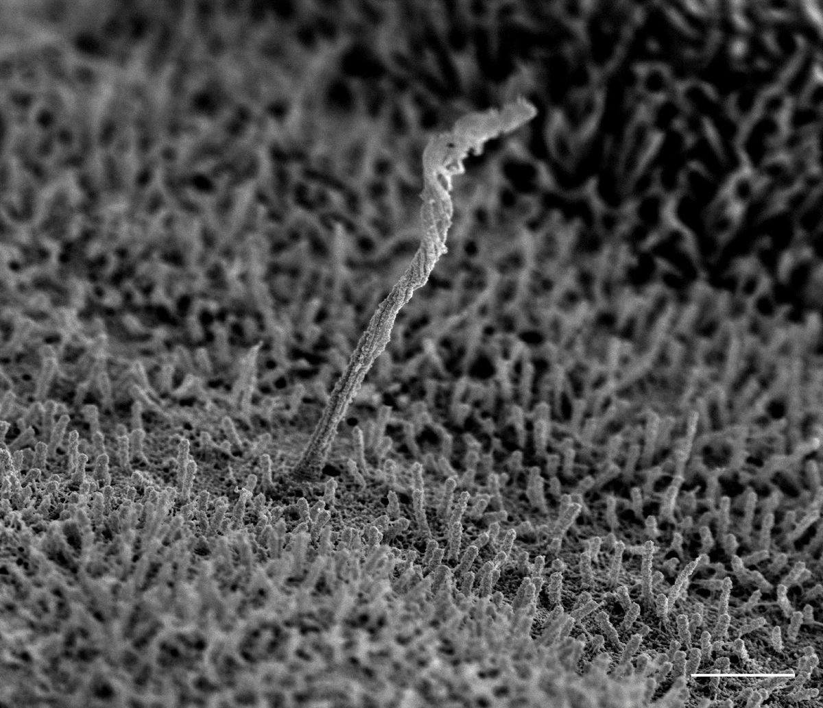 An antenna-like cellular structure emerges from the surface of a human pancreatic islet cell. The surface of the cell is covered with small structures called microvilli.