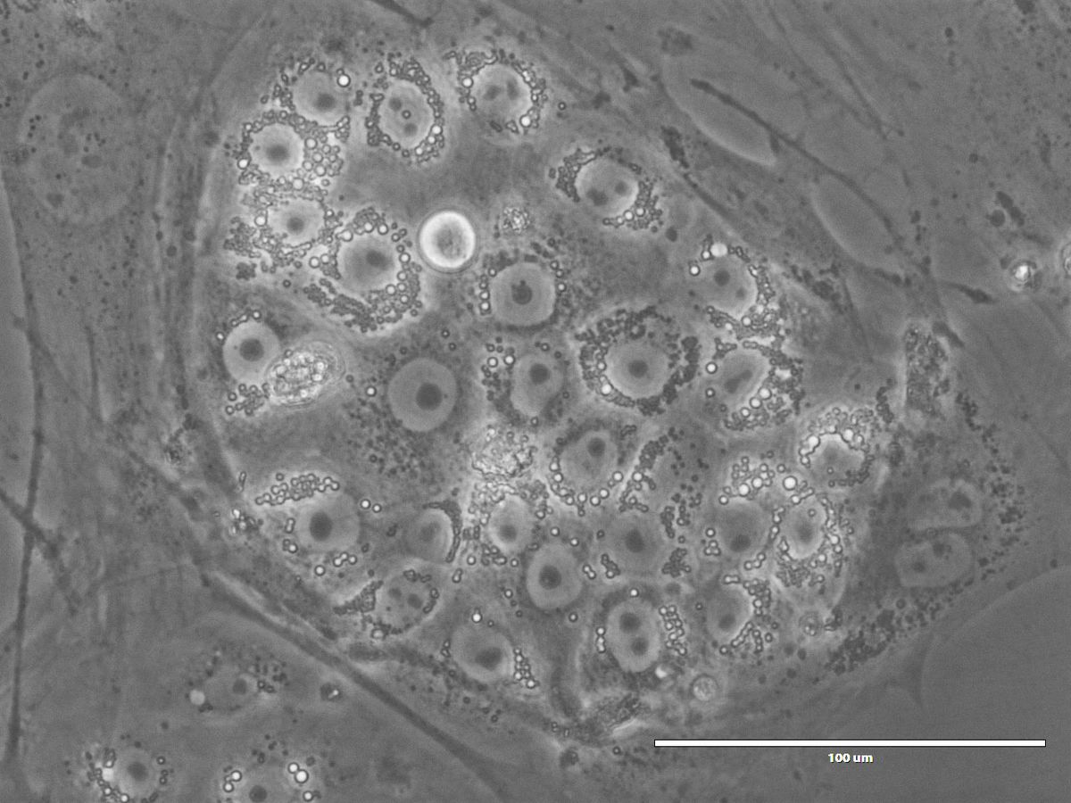 A greyscale microscopy image of a cluster of cells.