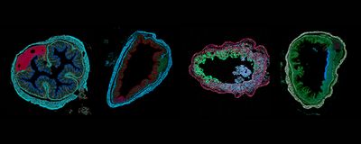 Cross sections of a mouse colon, where RNAs are colored depending on the local expression profile.