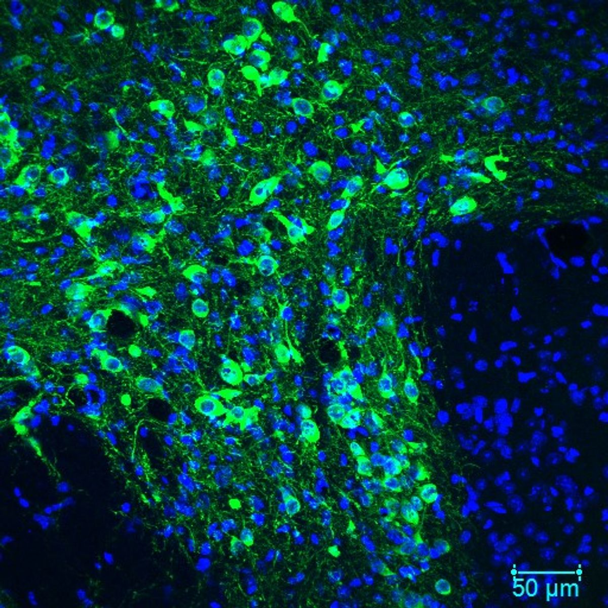 Cell bodies of dopamine neurons are stained green.