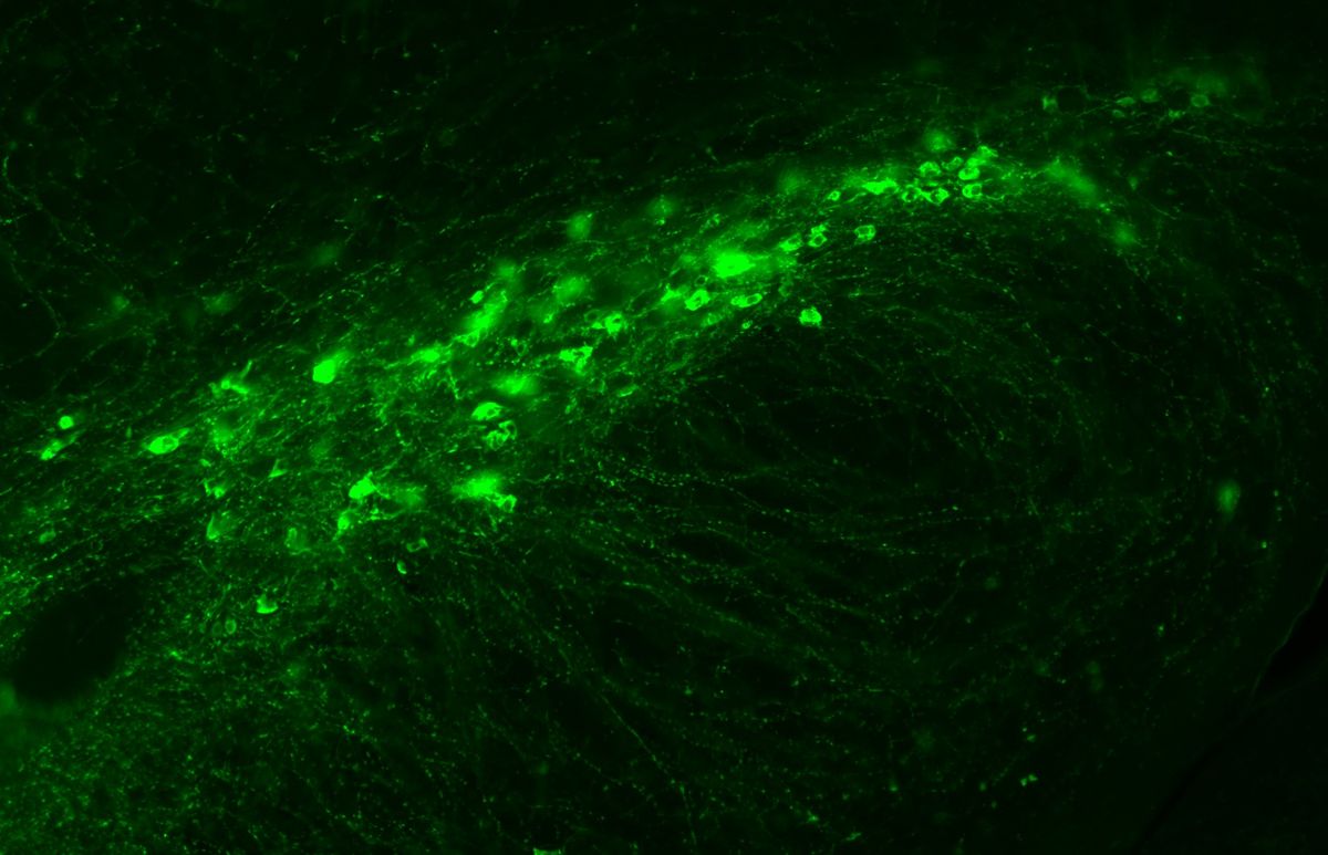 Dopamine neurons are stained green.