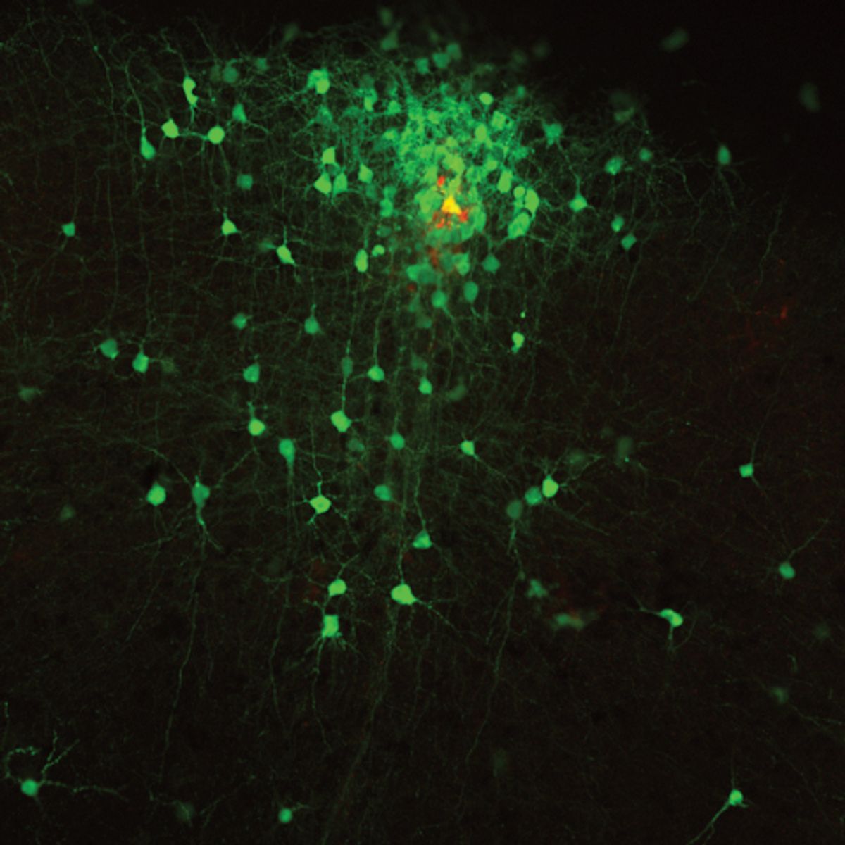 A single yellow neuron surrounded by many green neurons.