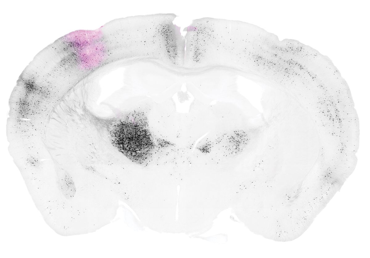 A coronal section of the mouse brain with an area of cortex in pink and black cell bodies in areas across the brain.