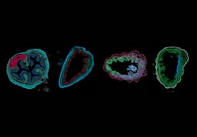 Cross sections of a mouse colon, where RNAs are colored depending on the local expression profile. &nbsp;