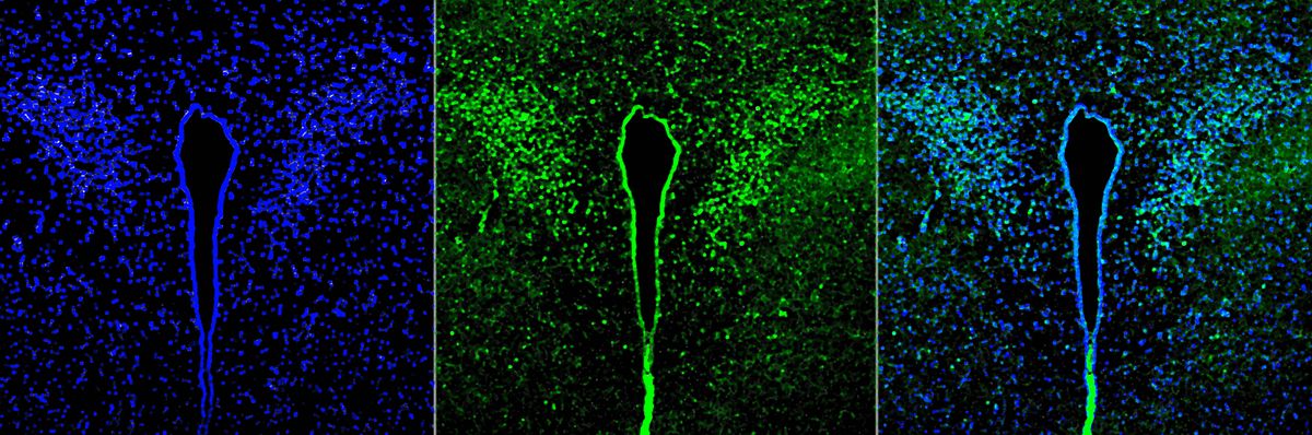 A three-panel image of a mouse brain after a lung infection with Pseudomonas that do not form biofilm. The left panel shows the nuclei of the neurons in blue, the middle panel shows the activated neurons in green, and the right panel shows a merged image of the first two.