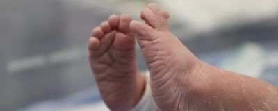 A photo of a newborn baby&rsquo;s feet with a hospital bracelet.