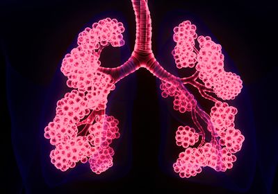 An artist&rsquo;s representation of the human respiratory system with pink airways on a blue and black background.