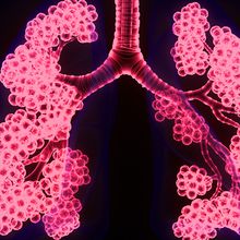 An artist&rsquo;s representation of the human respiratory system with pink airways on a blue and black background.