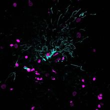 Lipofuscin autofluorescence was quenched using EverBrite TrueBlack&reg; Hardset Mounting Medium&reg;, allowing effective visualization of glial cells (GFAP antibody stain, cyan) and cell nuclei (magenta) in human cerebral cortex cryosections.