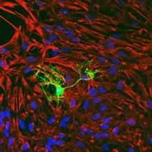 Microscopy image of a fluorescent green oligodendrocyte surrounded by astrocytes stained red with blue nuclei.