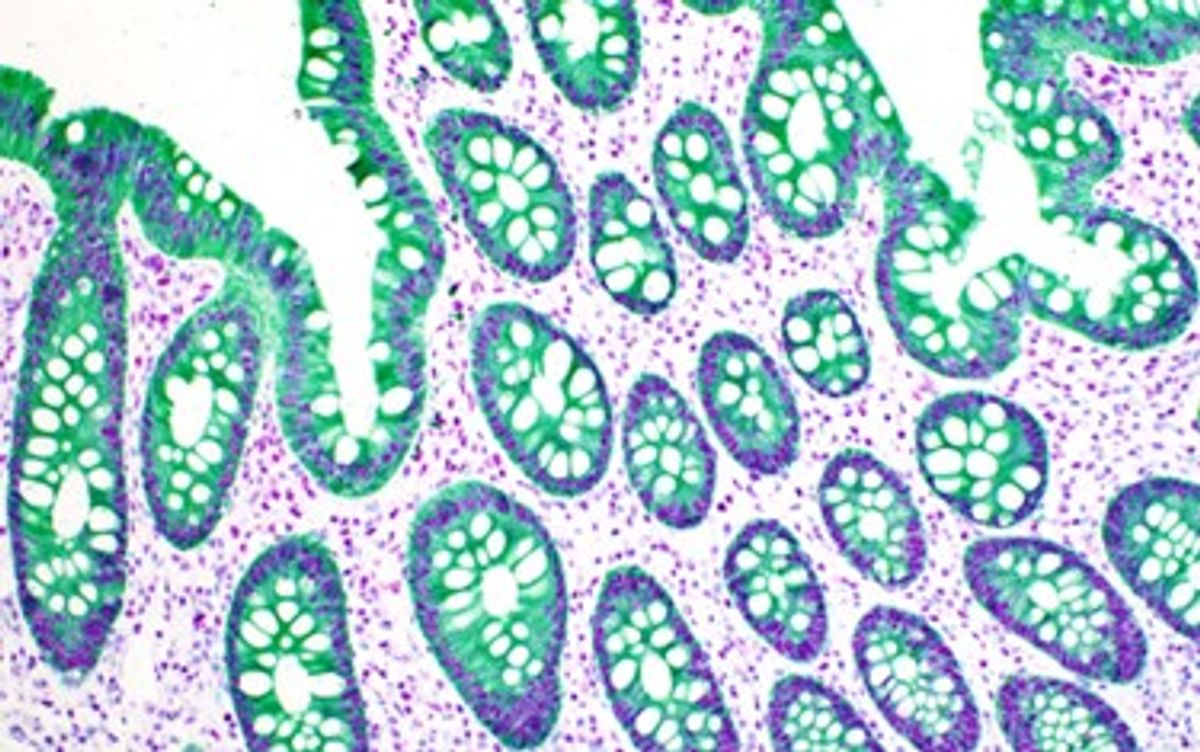 Double chromogenic IHC of normal colon tissue stained with antibodies to Bap1 (purple) and a cytokeratin cocktail (green) magnified 40x.  