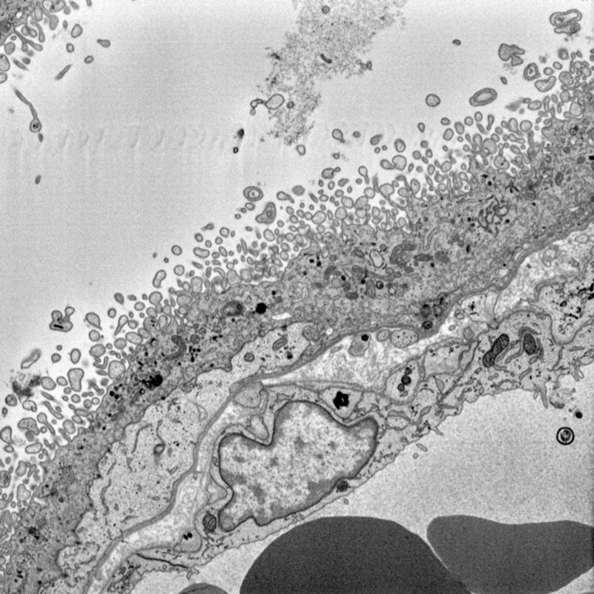 A black and white scanning electron microscopy image of cells within the placenta.