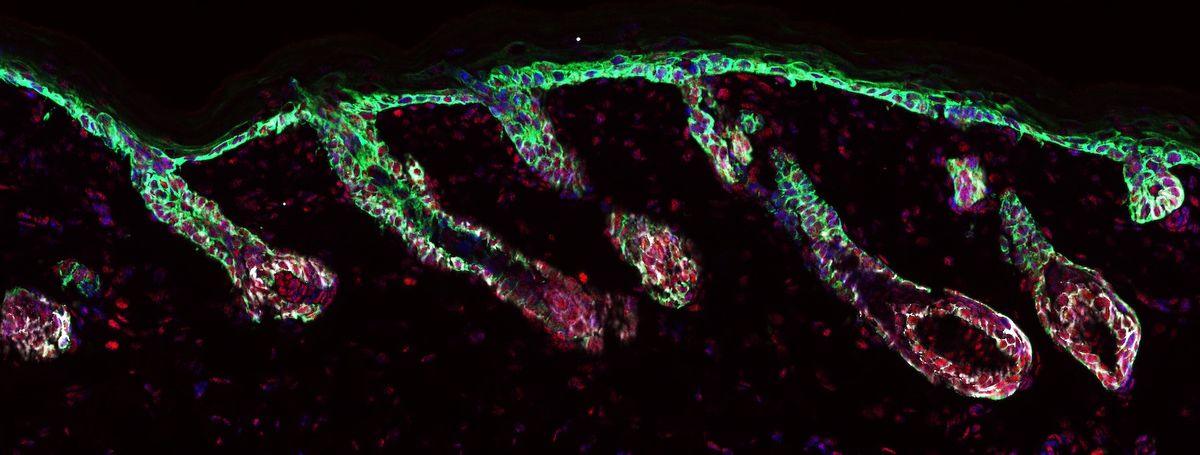 A microscopy image of fluorescently labeled cells in the hair follicles and the outer layer of the skin.