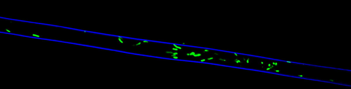 Fluorescent microscopy image of fungal walls labeled in blue with green-labeled bacteria inside.