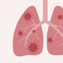 Human lung with viruses