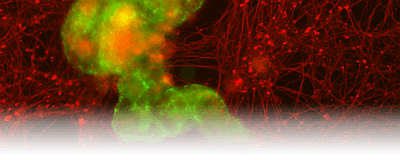 Image of aggregated anthrobots (green) forming a bridge between two neuronal cells (red).